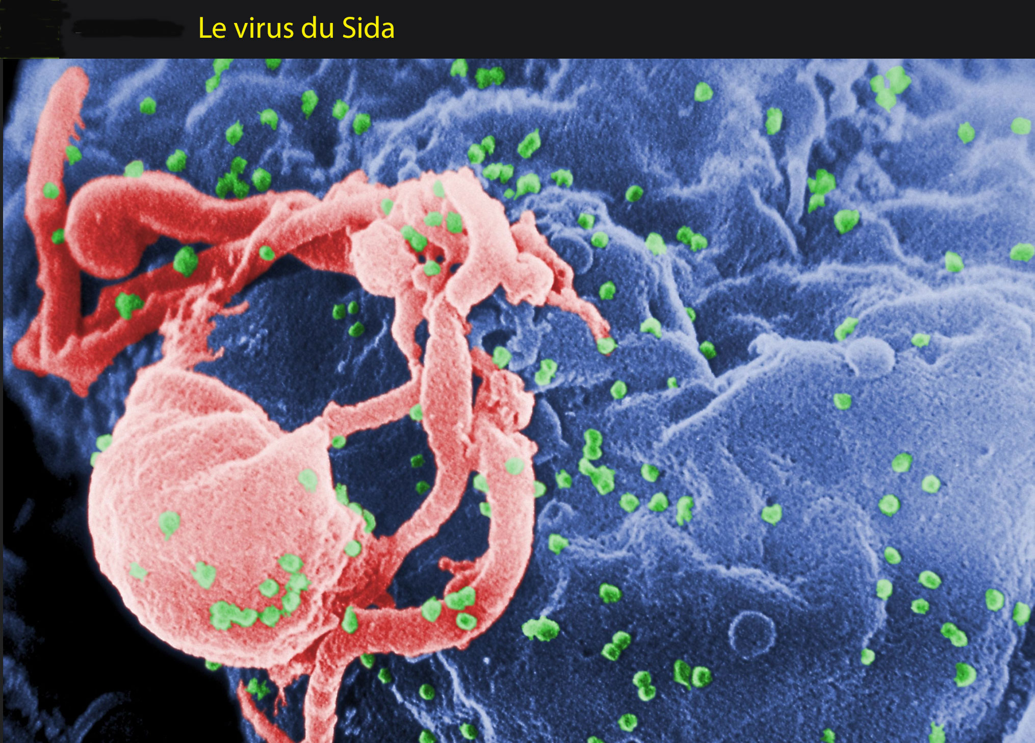 pourcentage prostituées sida